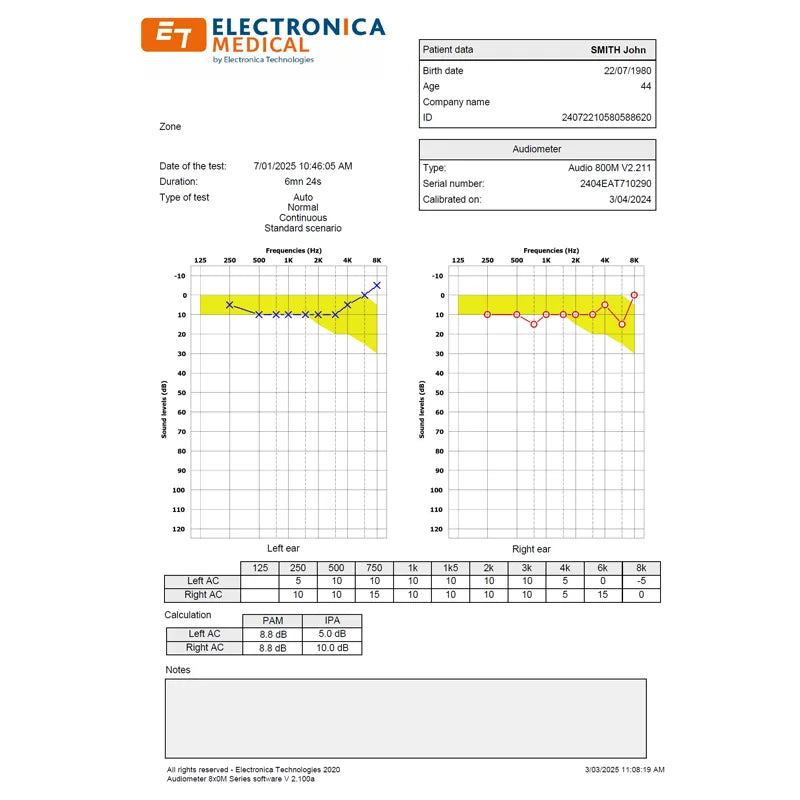 Electronica 800M PC Based Audiometer Test Report. Shop now at Zone Medical.