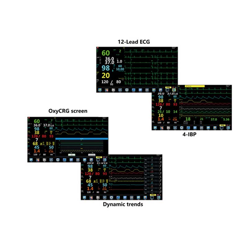 Northern Gemini Anaesthesia Patient Monitor