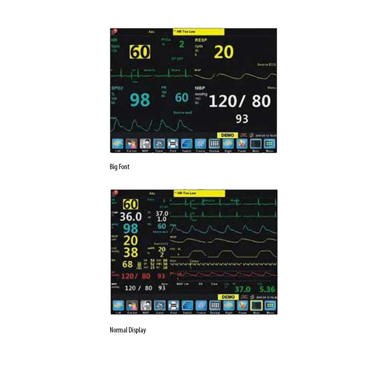 Northern Pisces Multiparameter Patient Monitor