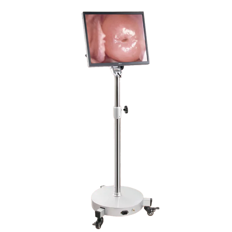 Alltion AC2000 Colposcope screen. Shop now at Zone Medical.