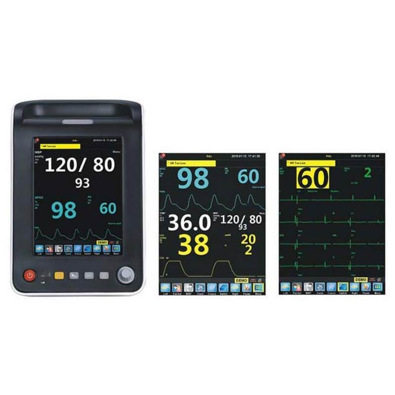 Northern Aquarius Plus Patient Monitor with ECG & Touchscreen