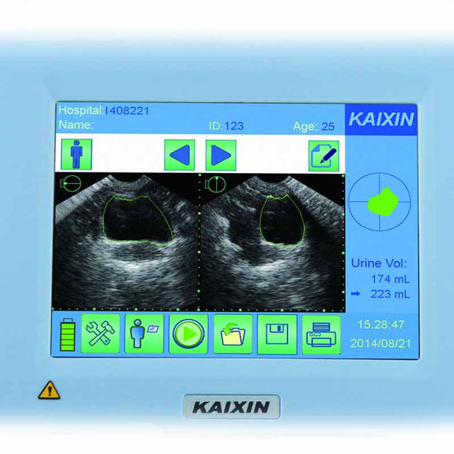 Kaixin BVT01 Bladder Scanner with Touch Screen and Printer – Zone Medical