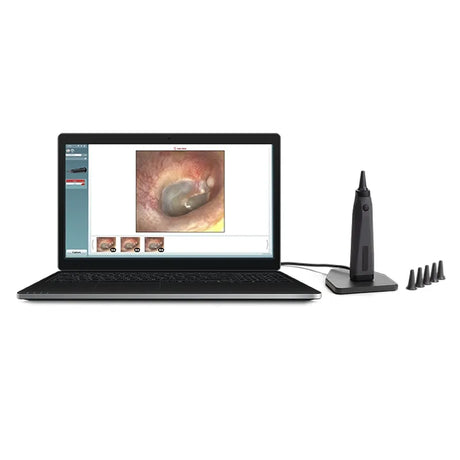 Interacoustics Viot Otoscope hero image. Shop now at Zone Medical.