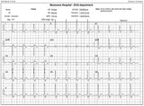 Beneware CS180 Cardioshield PC Based ECG