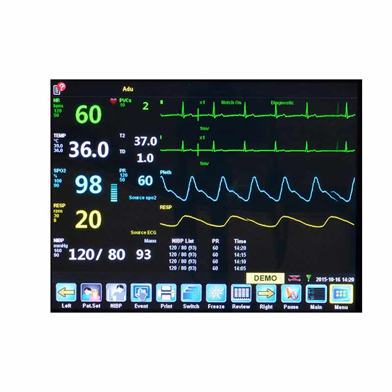 Northern Taurus ICU Multiparameter Patient Monitor